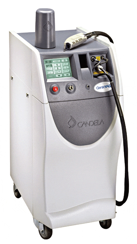 ND Yag Laser