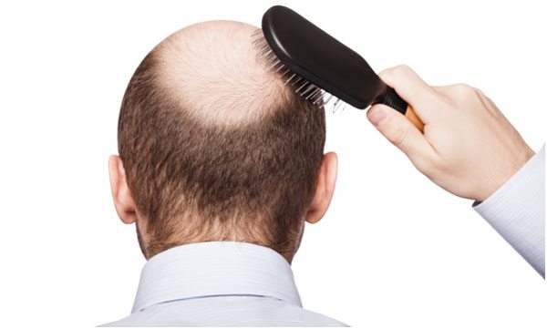 lasertouch-hair-loss-treatment